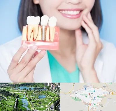 متخصص ایمپلنت در بجنورد