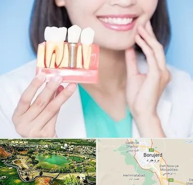 متخصص ایمپلنت در بروجرد