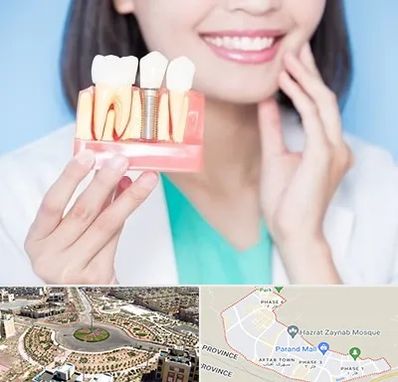 متخصص ایمپلنت در پرند