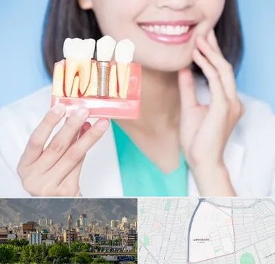 متخصص ایمپلنت در جمشیدیه