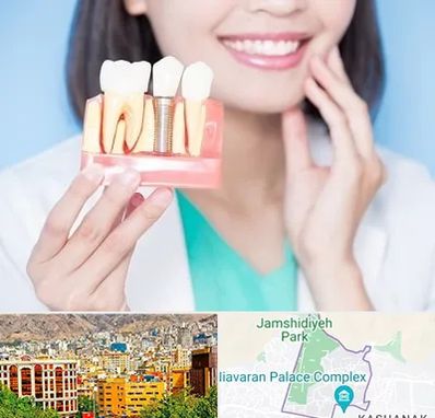 متخصص ایمپلنت در نیاوران