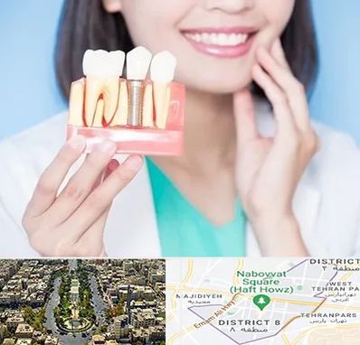 متخصص ایمپلنت در نارمک