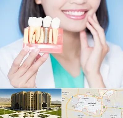 متخصص ایمپلنت در نجف آباد