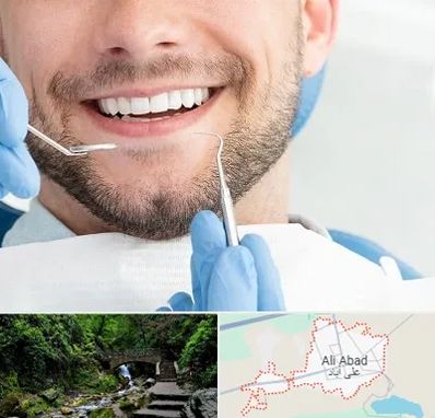 دندانپزشکی شبانه روزی در علی آباد کتول