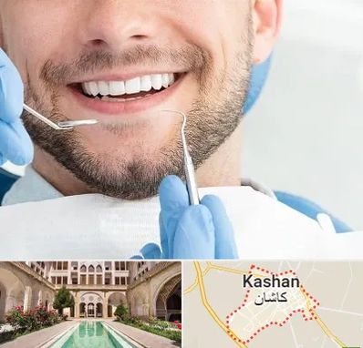 دندانپزشکی شبانه روزی در کاشان