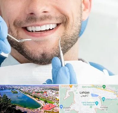 دندانپزشکی شبانه روزی در لاهیجان