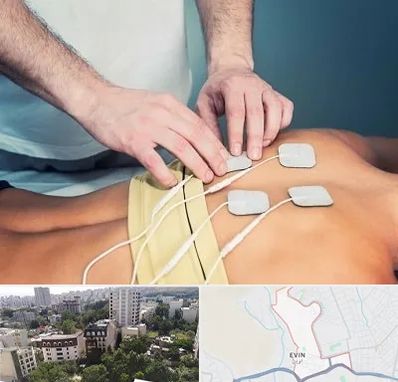 فیزیوتراپیست در اوین