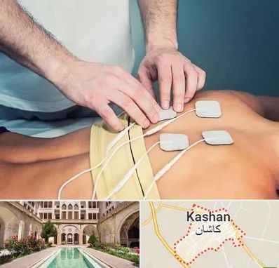 فیزیوتراپیست در کاشان