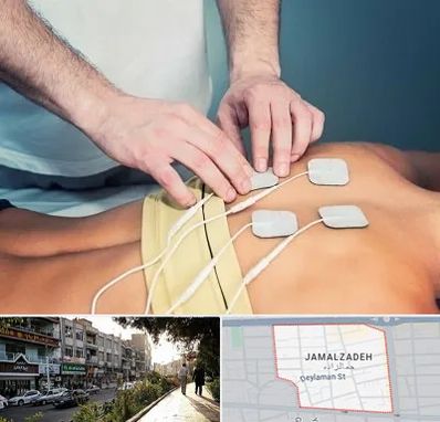 فیزیوتراپیست در خیابان جمالزاده