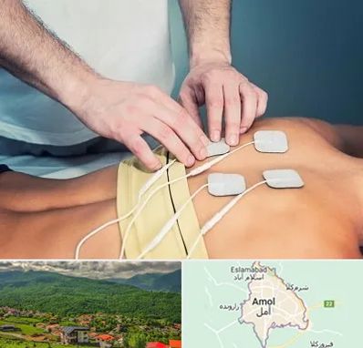 فیزیوتراپیست در آمل