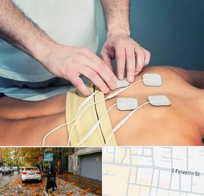 فیزیوتراپیست در خیابان فلسطین