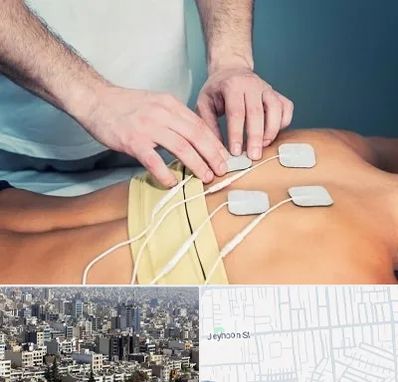 فیزیوتراپیست در جیحون