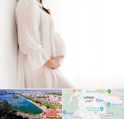 فروشگاه لباس بارداری در لاهیجان