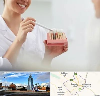 دکتر دندانساز در تایباد