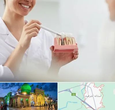 دکتر دندانساز در آستانه اشرفیه