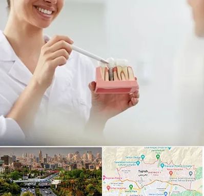 دکتر دندانساز در منطقه 1 تهران 