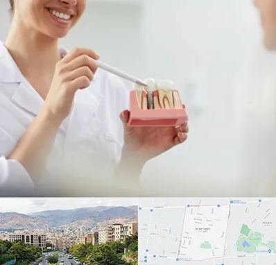 دکتر دندانساز در خانی آباد 