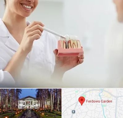 دکتر دندانساز در باغ فردوس
