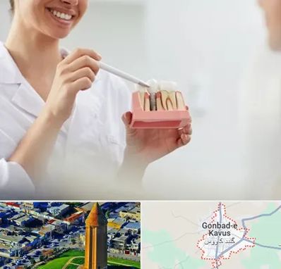 دکتر دندانساز در گنبد کاووس