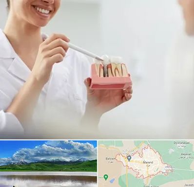 دکتر دندانساز در مرند