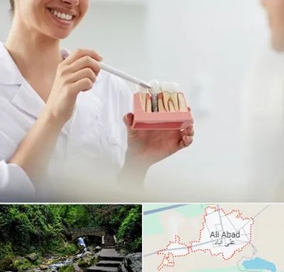 دکتر دندانساز در علی‌ آباد کتول