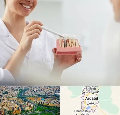 دکتر دندانساز در اردبیل