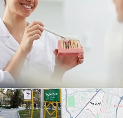 دکتر دندانساز در تهران ویلا