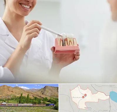 دکتر دندانساز در خاش