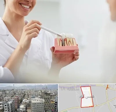 دکتر دندانساز در شمس آباد تهران