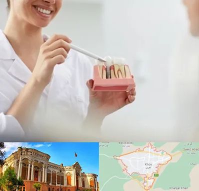 دکتر دندانساز در خوی