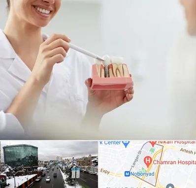 دکتر دندانساز در اقدسیه 