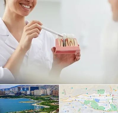 دکتر دندانساز در منطقه 22 تهران 