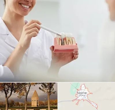 دکتر دندانساز در تویسرکان