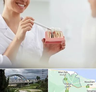 دکتر دندانساز در چالوس