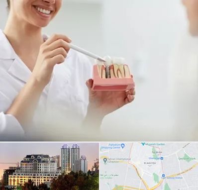 دکتر دندانساز در فرشته 