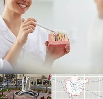 دکتر دندانساز در زابل
