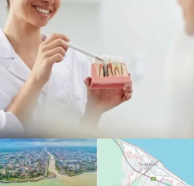 دکتر دندانساز در تنکابن