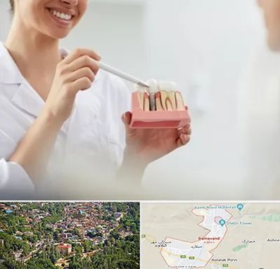 دکتر دندانساز در دماوند