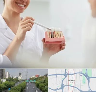 دکتر دندانساز در توانیر