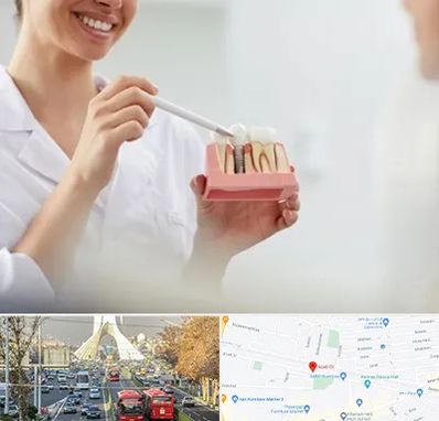 دکتر دندانساز در خیابان آزادی 