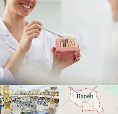 دکتر دندانساز در بانه