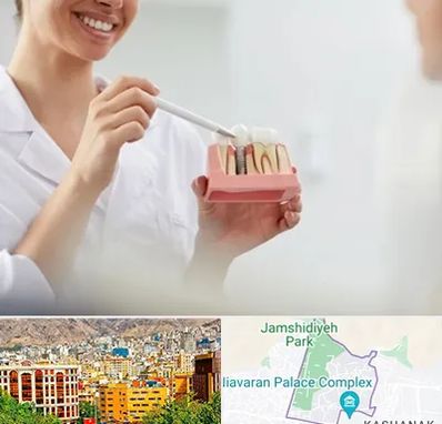 دکتر دندانساز در نیاوران 