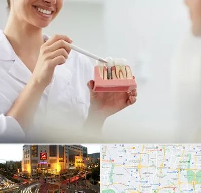 دکتر دندانساز در جنت آباد تهران 