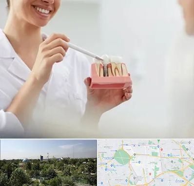 دکتر دندانساز در منطقه 16 تهران 