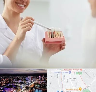 دکتر دندانساز در گلسار رشت 