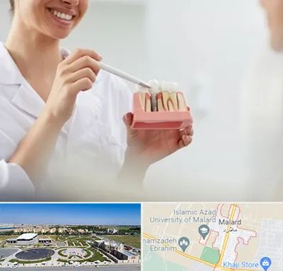 دکتر دندانساز در ملارد