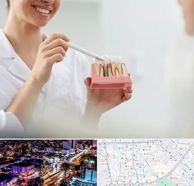 دکتر دندانساز در منظریه رشت