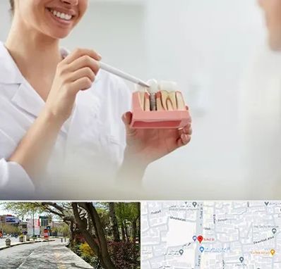 دکتر دندانساز در خیابان توحید اصفهان