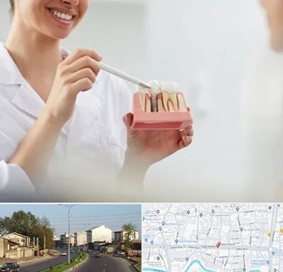 دکتر دندانساز در ضیابری رشت