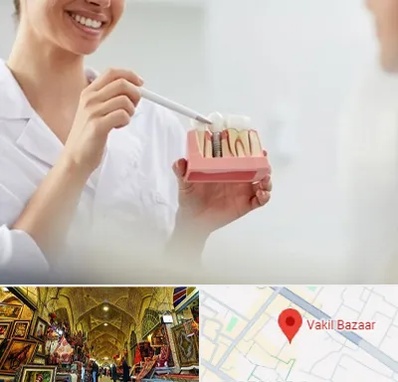 دکتر دندانساز در بازار وکیل شیراز